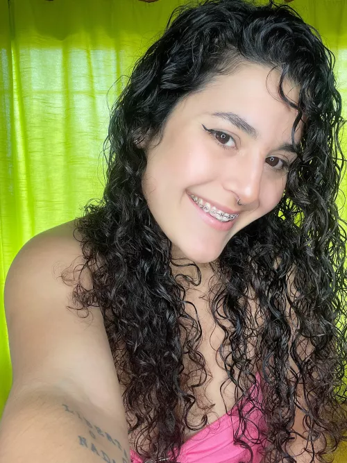 I feel that braces are a perfect accessory.