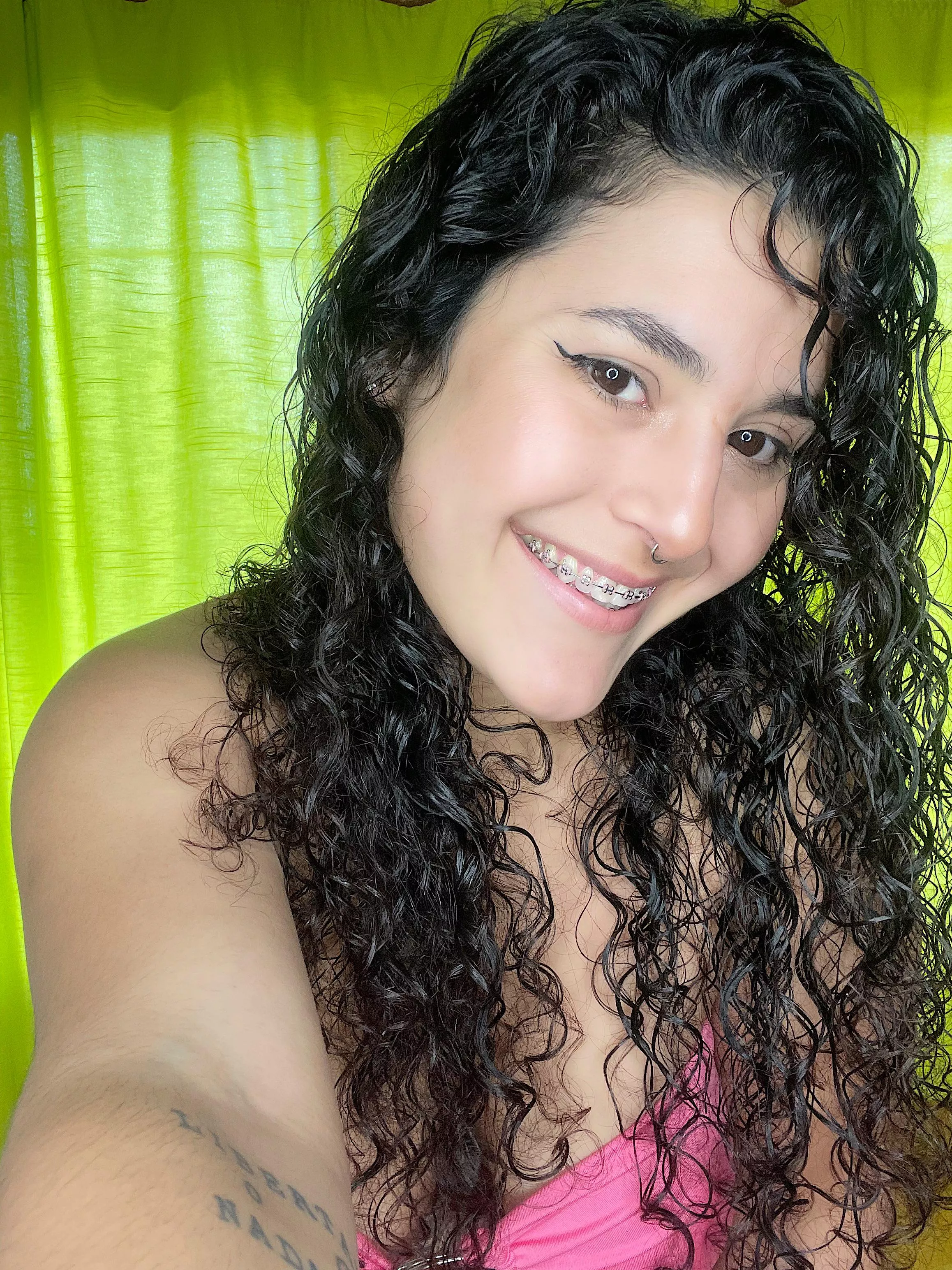 I feel that braces are a perfect accessory.