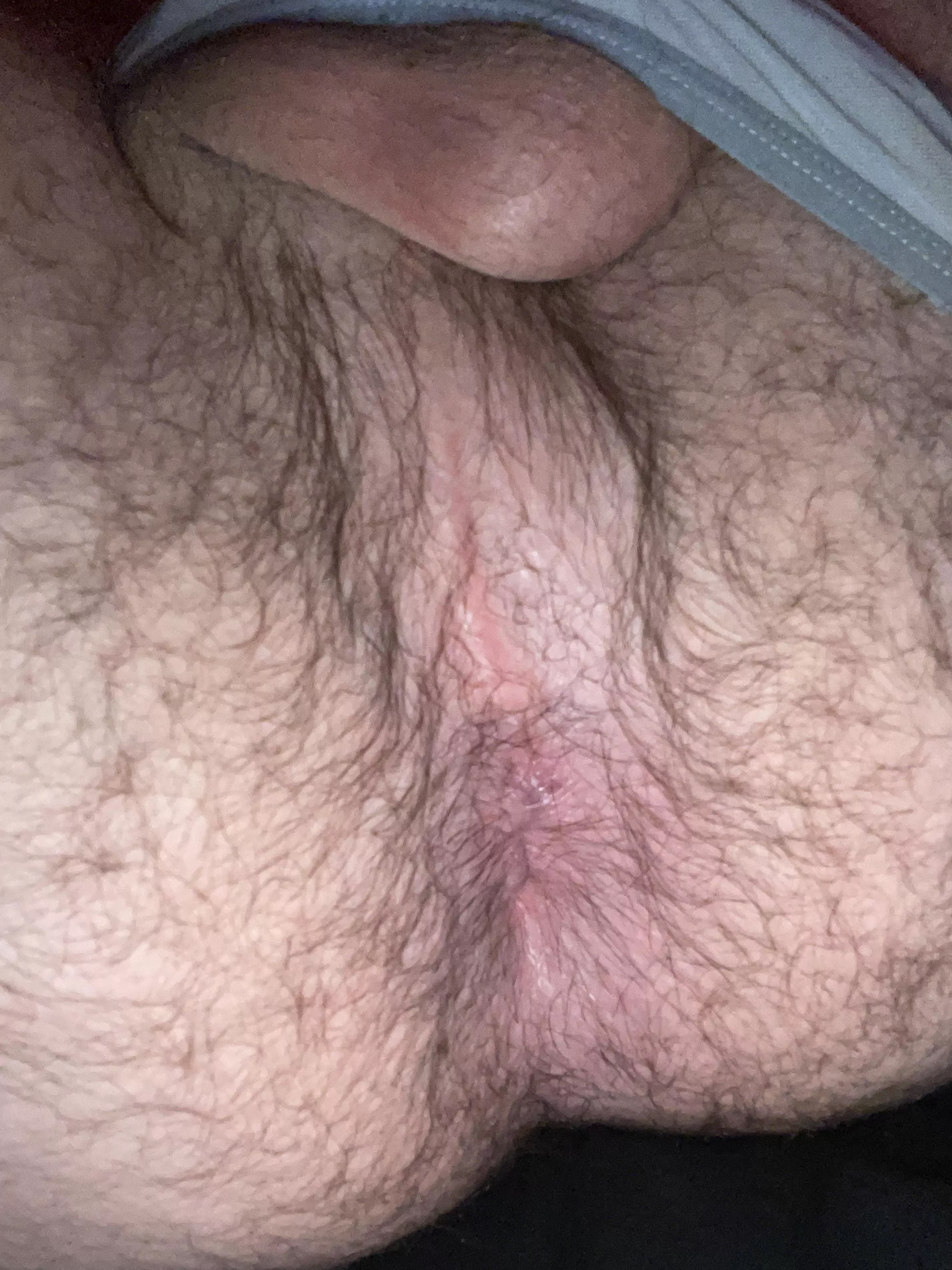 (24) need to get filled up 