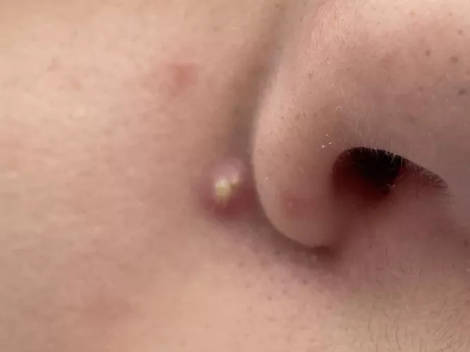Forbidden pop on my son. 