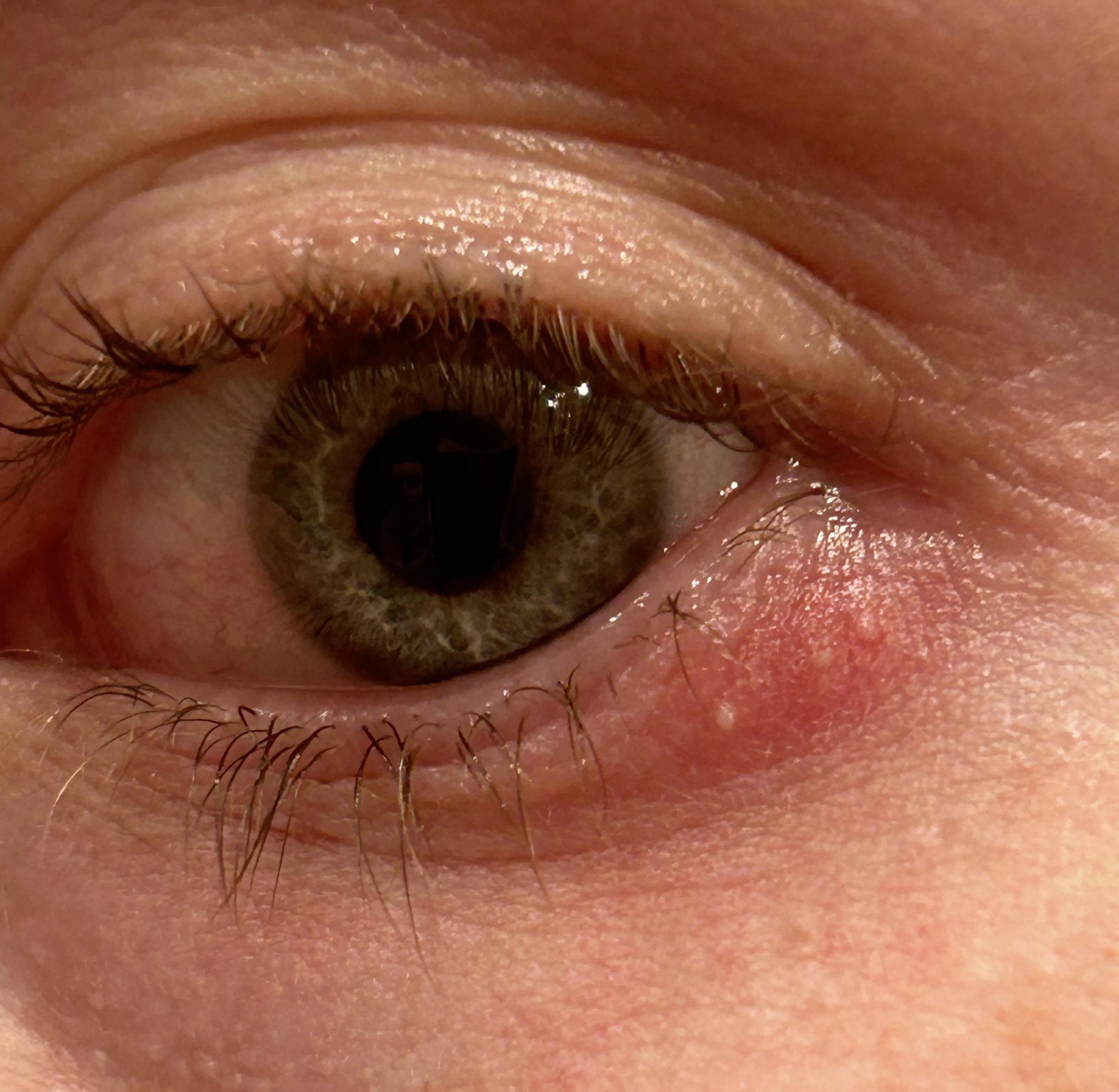 forbidden eyeball adjacent pop trio (... but I'm considering it)