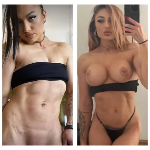 my surgeon deserves a trophy, sure i go for more? 