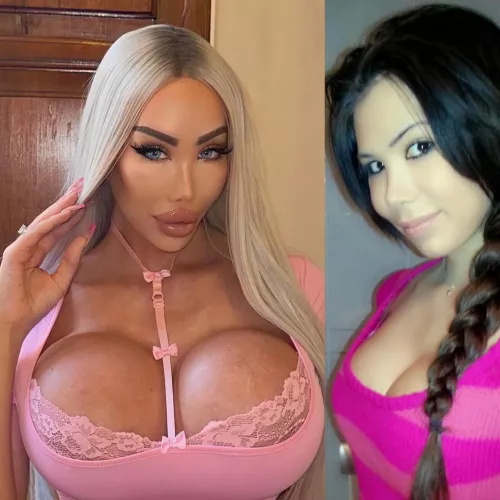 People act as if it's just paying for a new body and now you're a bimbo. It's not that easy. Every surgery is a process. Often you have to repeat, because it's not magic. It's painful, risky and expensive. Then there's society and the hate. The rea