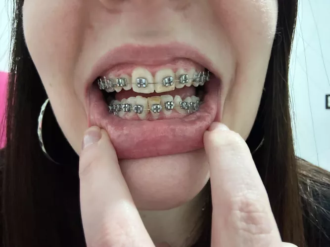 Thread to show my progress: 1 month :)