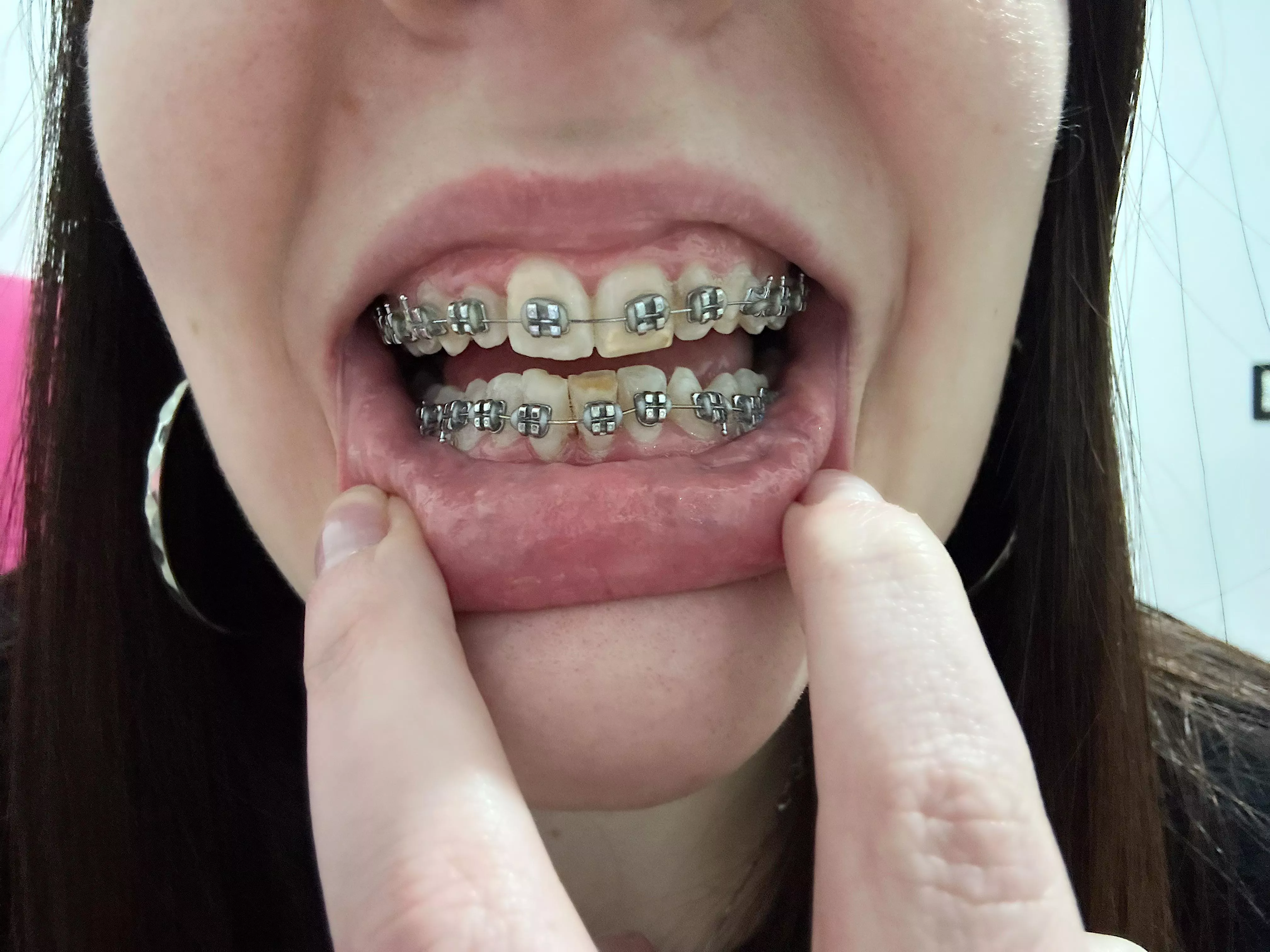 Thread to show my progress: 1 month :)