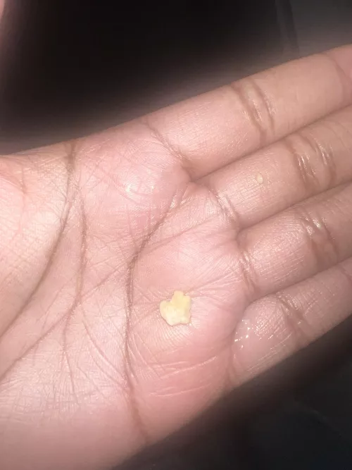 Welp just spent 20 minutes coughing this up