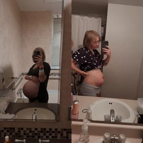 Last pregnancy pic vs postpartum 