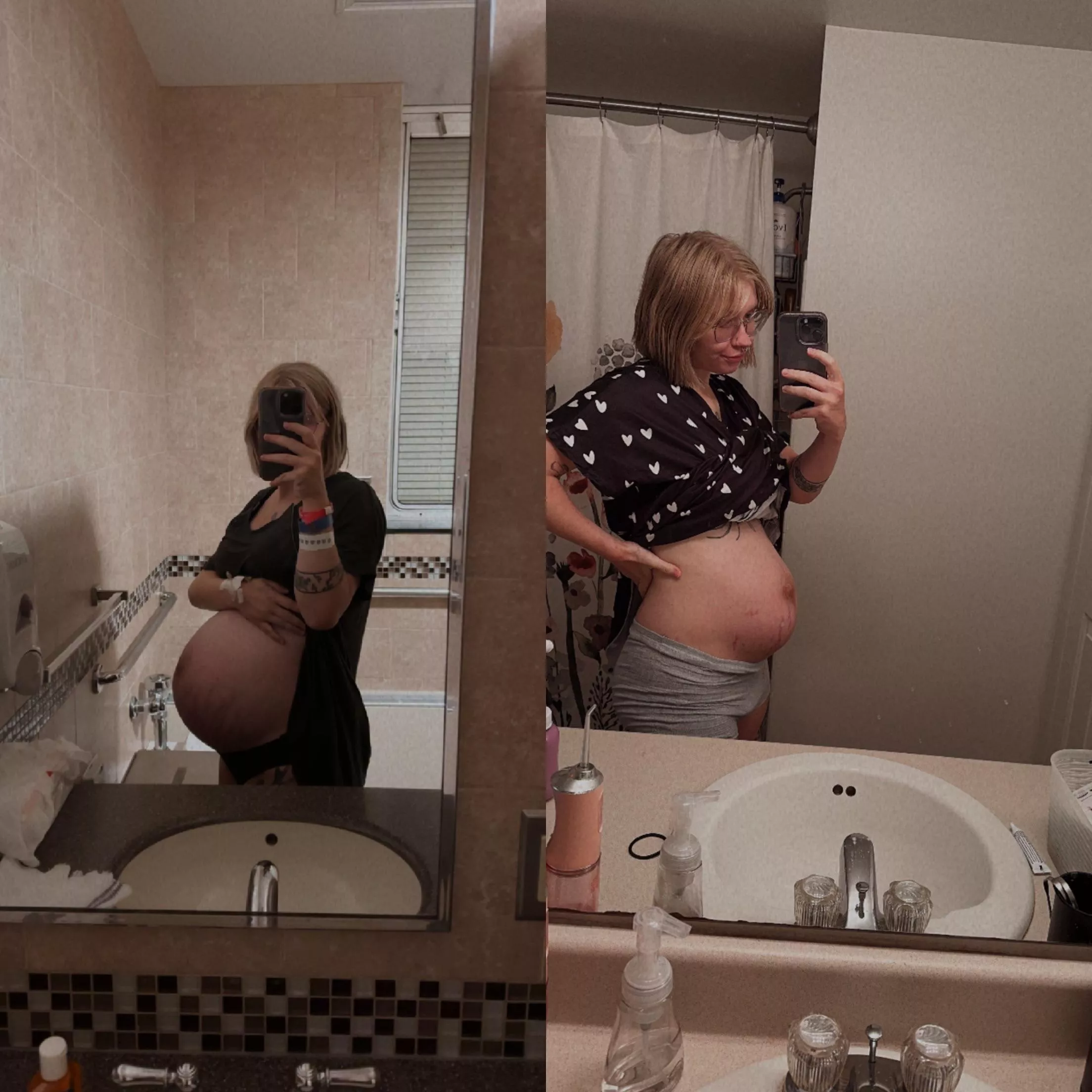 Last pregnancy pic vs postpartum 