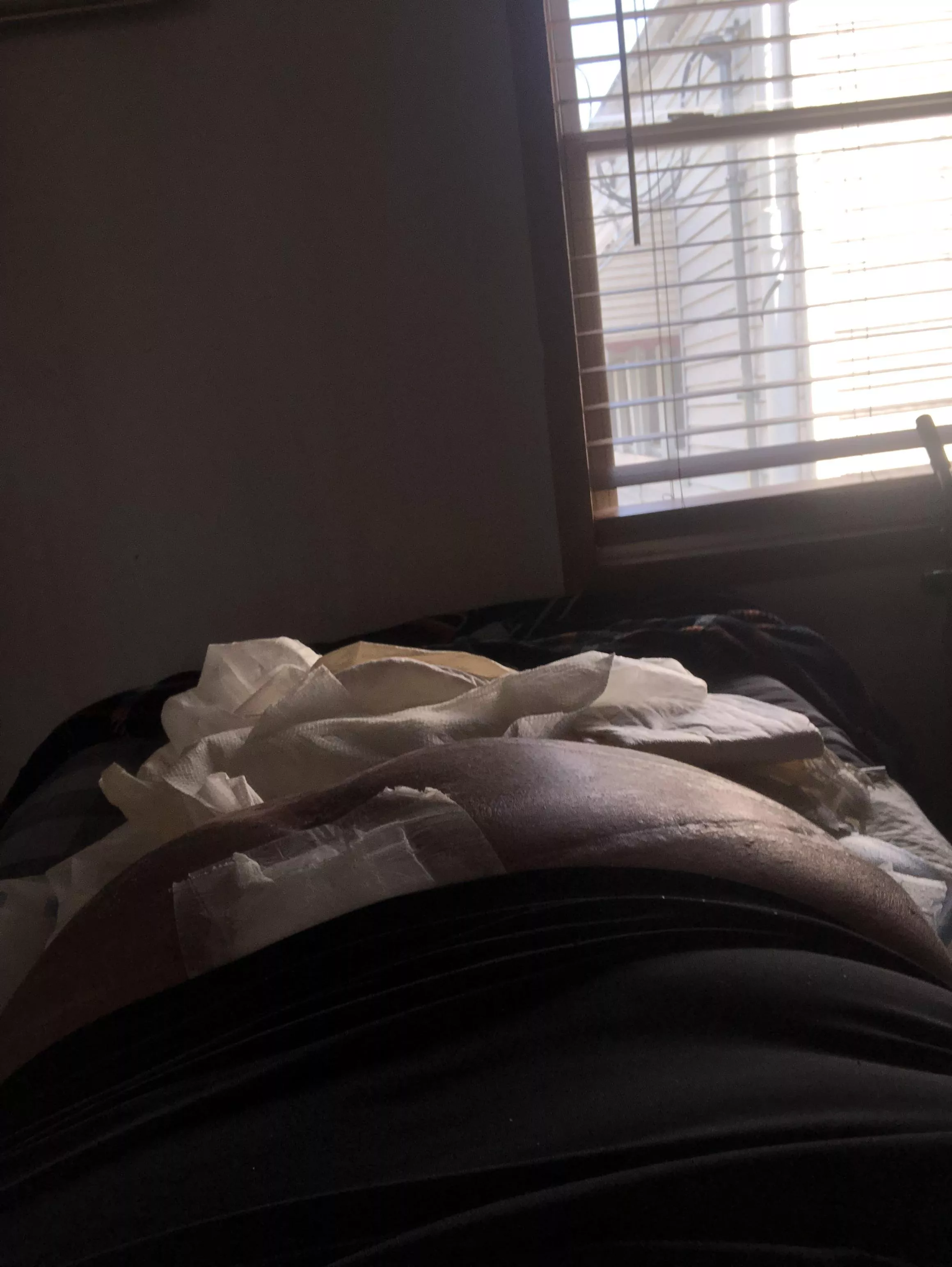 Gay superchub bottom in a wheelchair and paralyzed from the waist down with a big ass. Looking in the US.  Sorry for the bandage if you’re still interested hmu