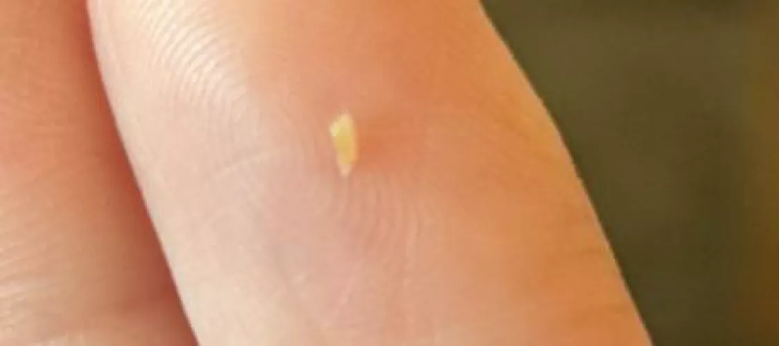 Little things that come out of my back 