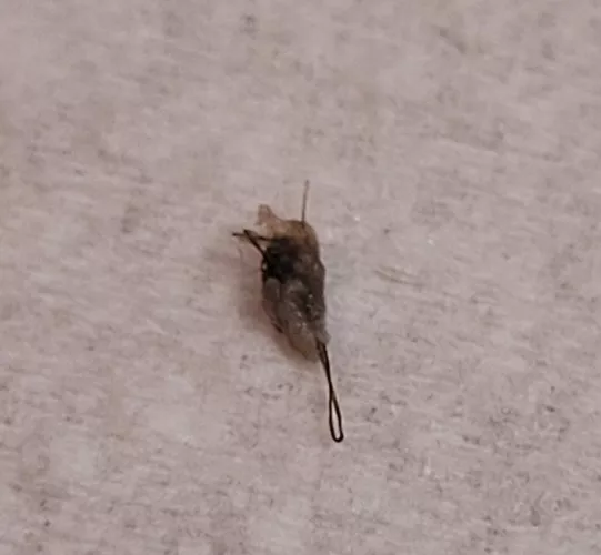 This is what came out of a bump on my thigh. Wish I had recorded; the pop was audible.