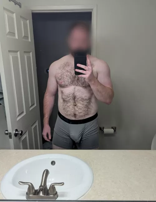 31 - Are soft bulges allowed?