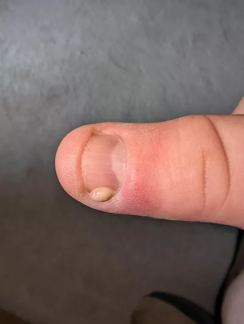 The relief was immense