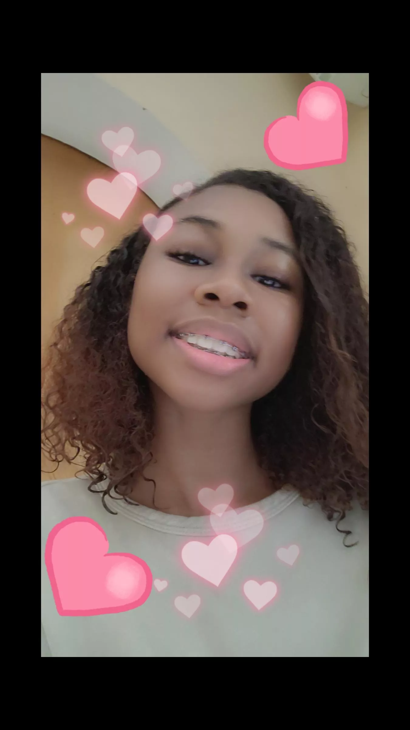 Brace face baby girll 🥰🥰🧁