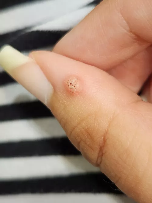 Feel like I should just take some nail clippers to this thing. 