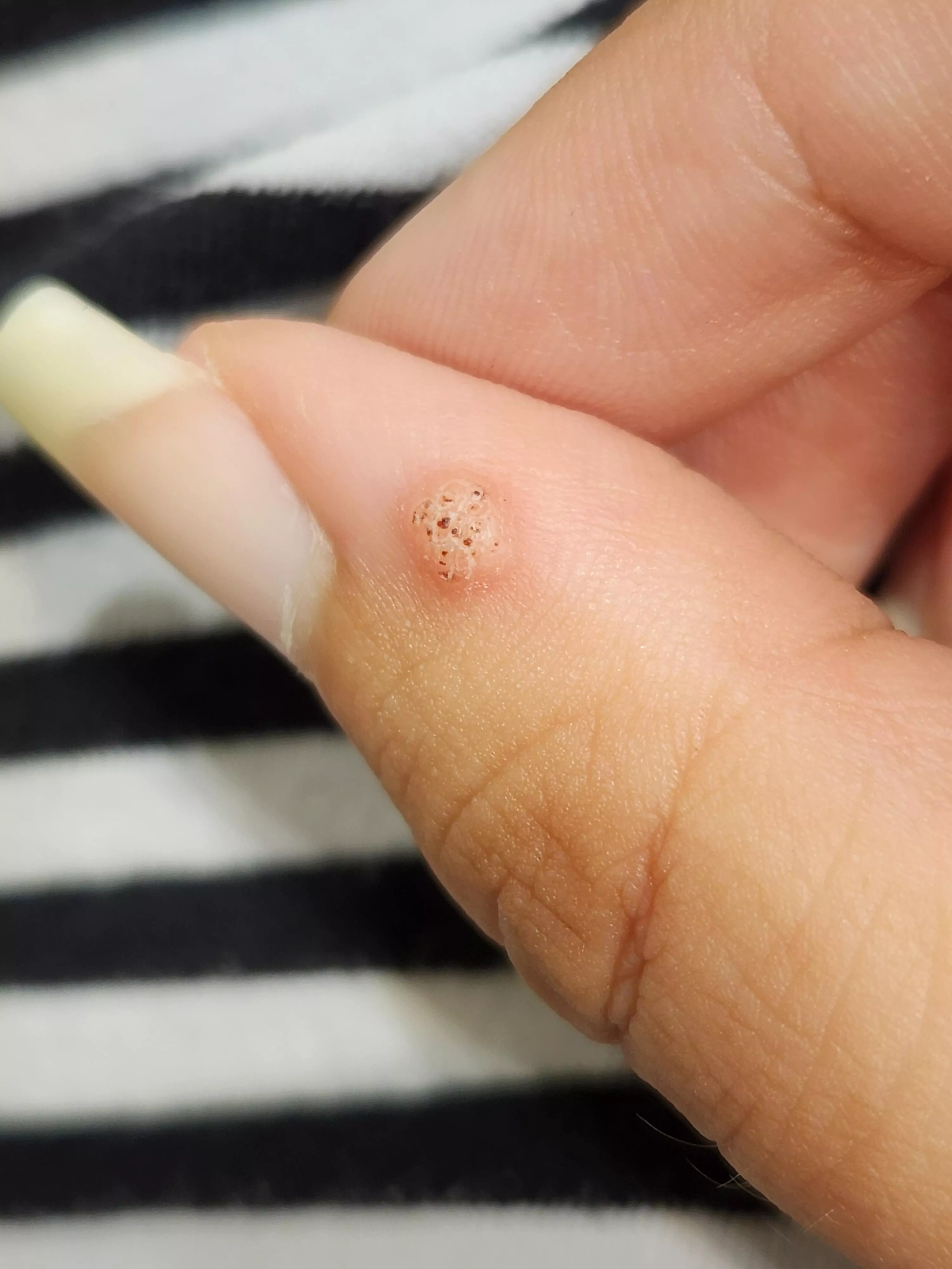 Feel like I should just take some nail clippers to this thing. 