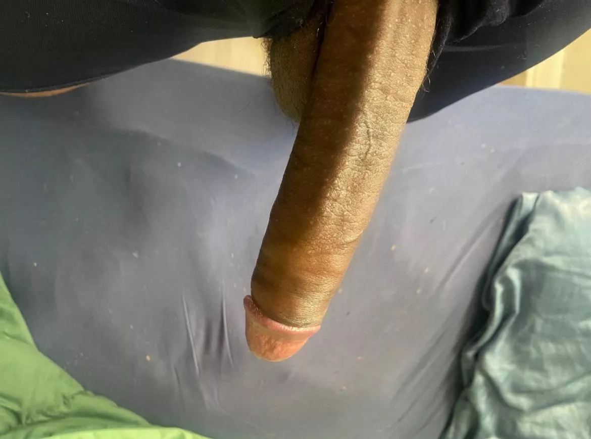 My dick “accidentally” slips out in front of you. Wyd? 