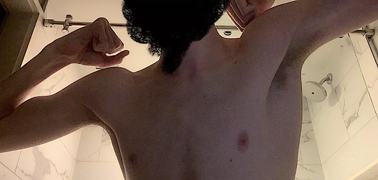 High schooler’s pits [18]