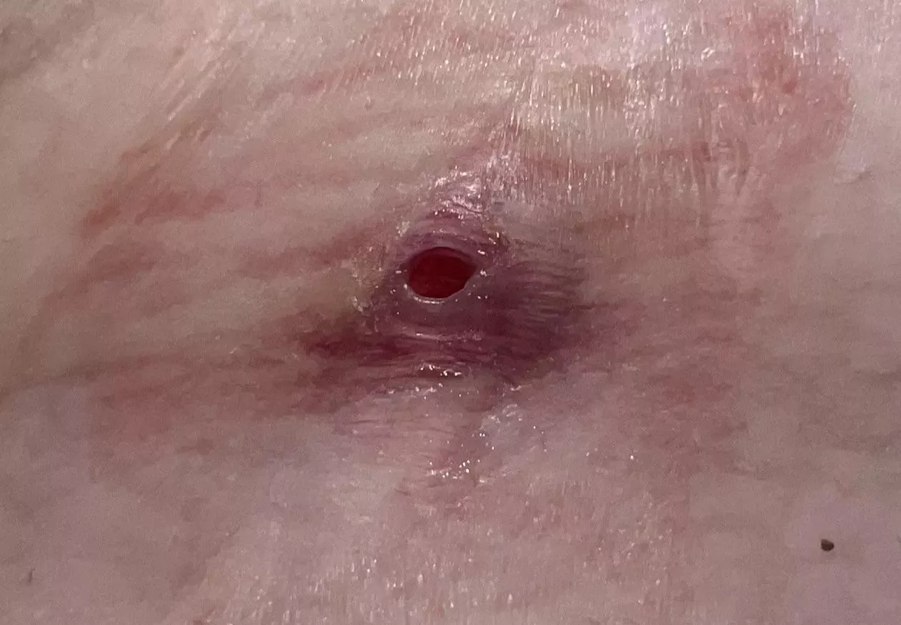 Check out my first ever boil CRATER