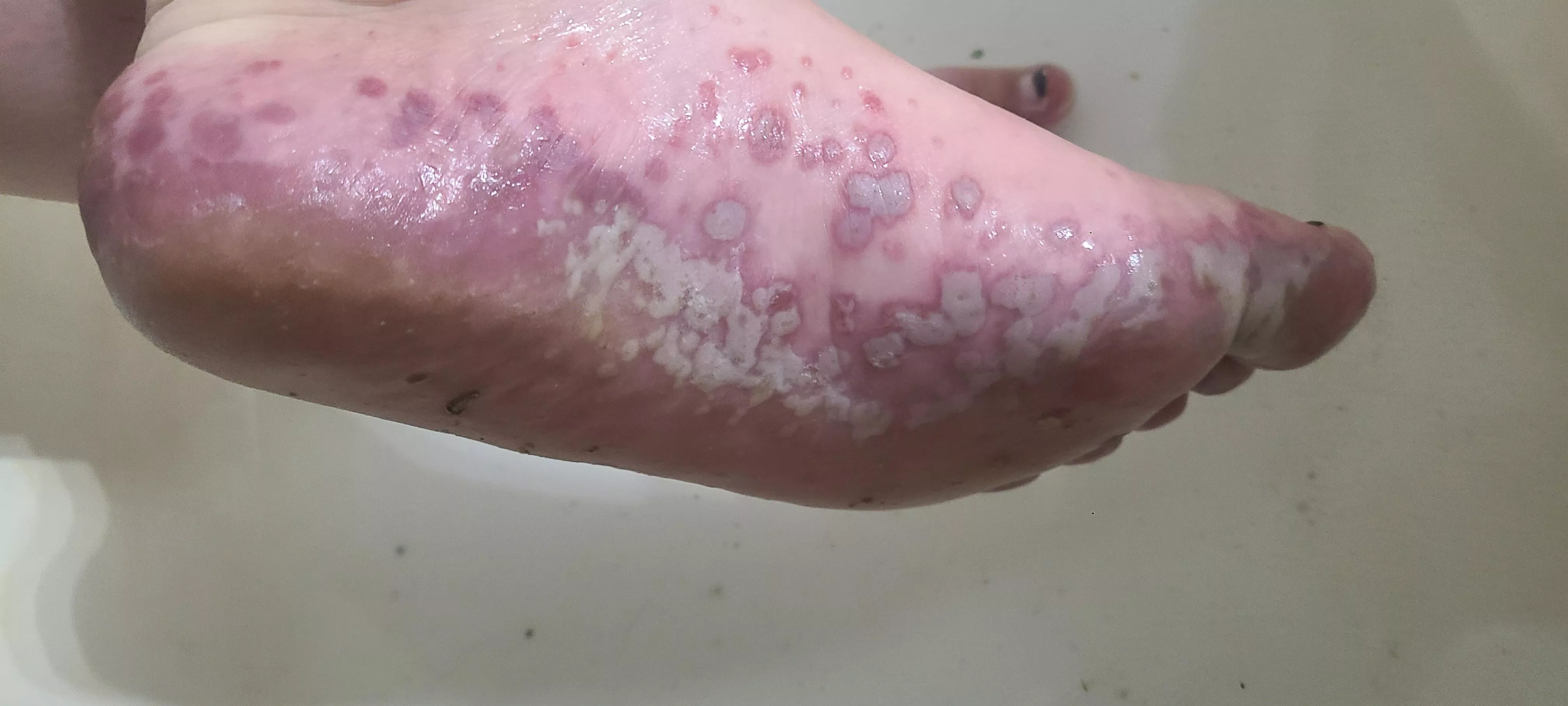 Forbidden Pop: Hand Foot Mouth