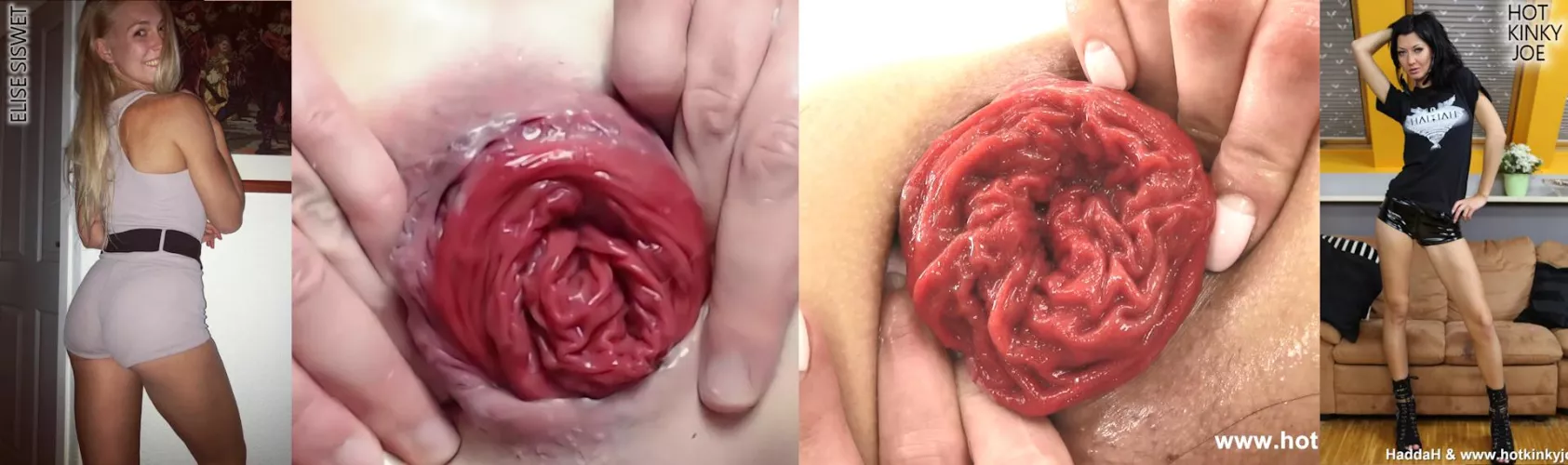 Choose your juicy rektal 🌹 !