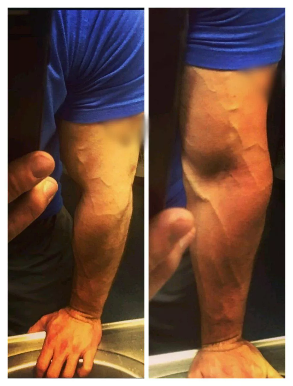 Hopefully a little bicep is welcome 