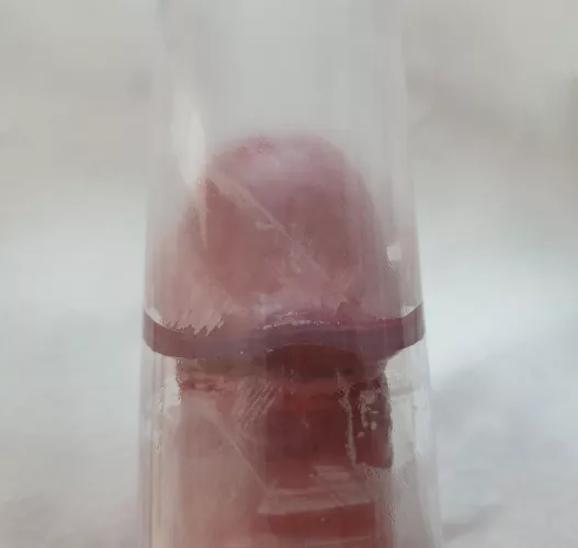 Tapering tube, frenulum touching all around. Should I get a bigger tube?