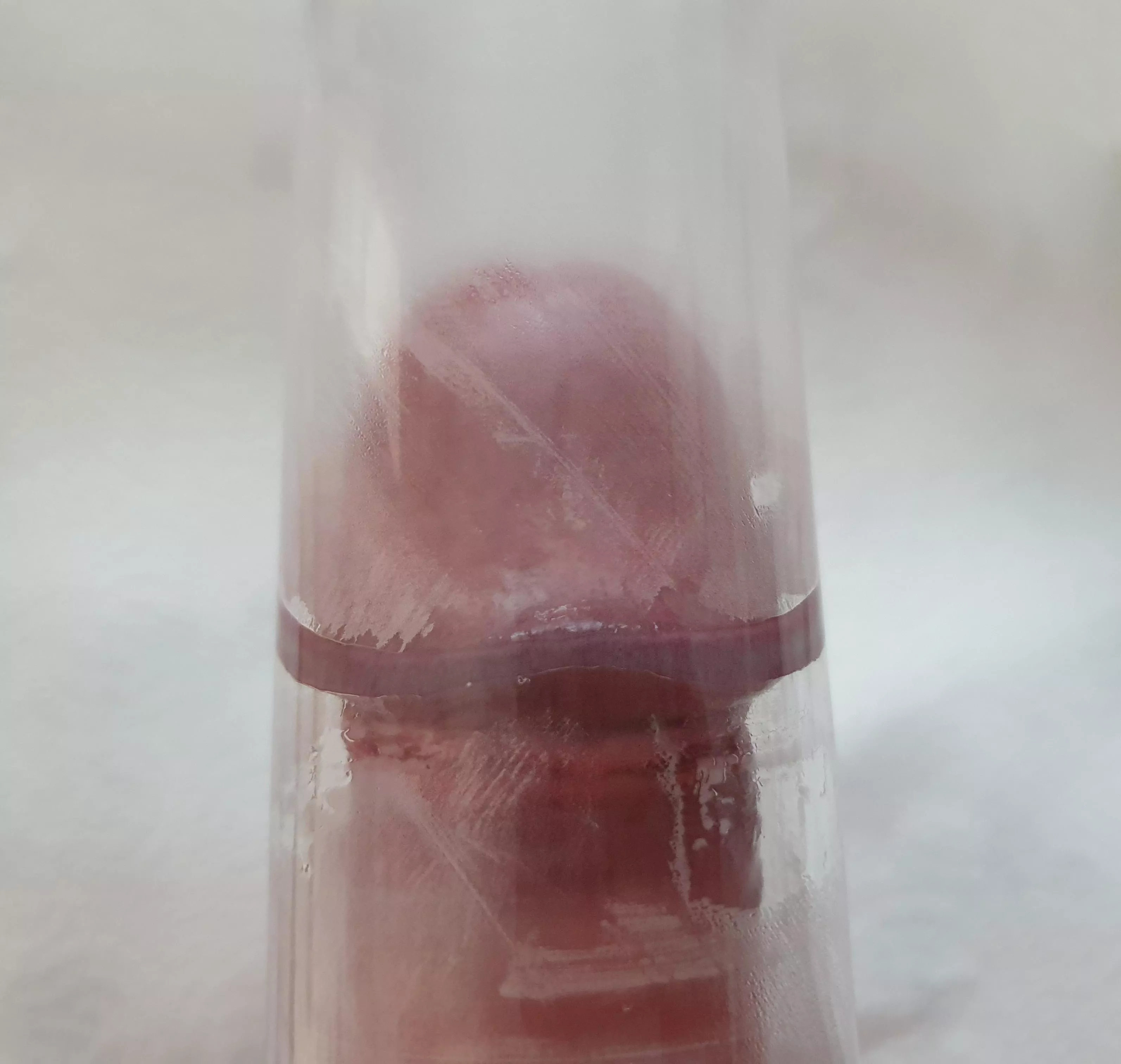 Tapering tube, frenulum touching all around. Should I get a bigger tube?