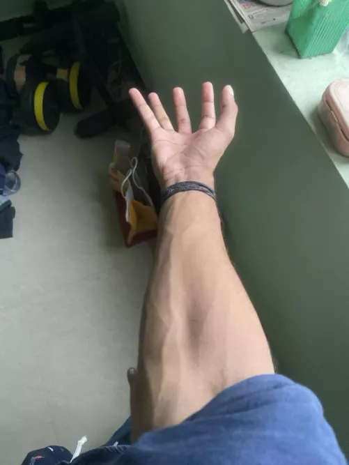 What’s your insist reaction 