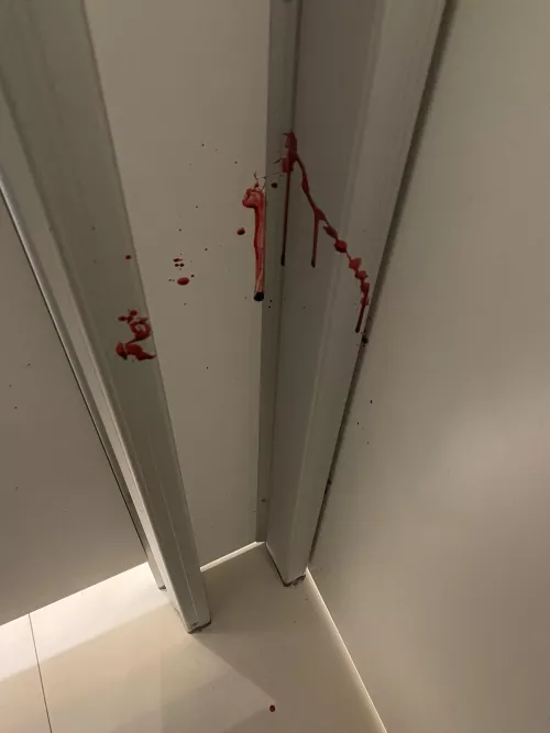 Aftermath of boil that popped during work