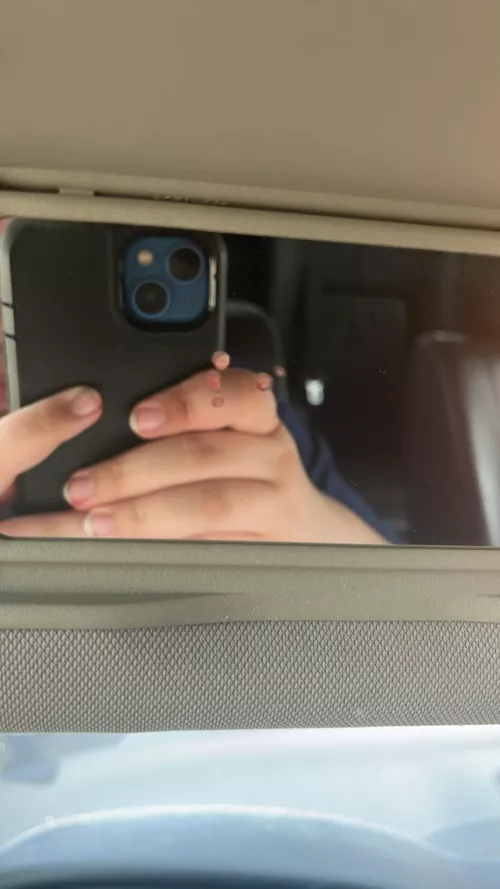 Aftermath of popping a forehead cyst in the car 