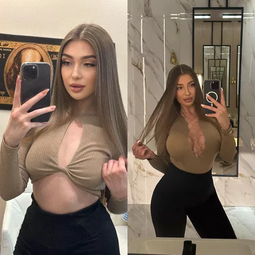 I think my 750 cc boobs suit me better than my natural boobs