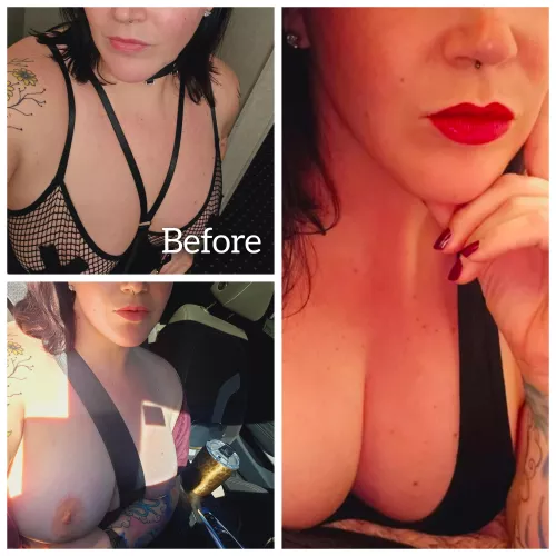 She asked if she should get her lips filled again before her implants in November