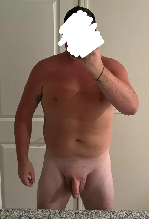 Went to the beach and got fried today! 