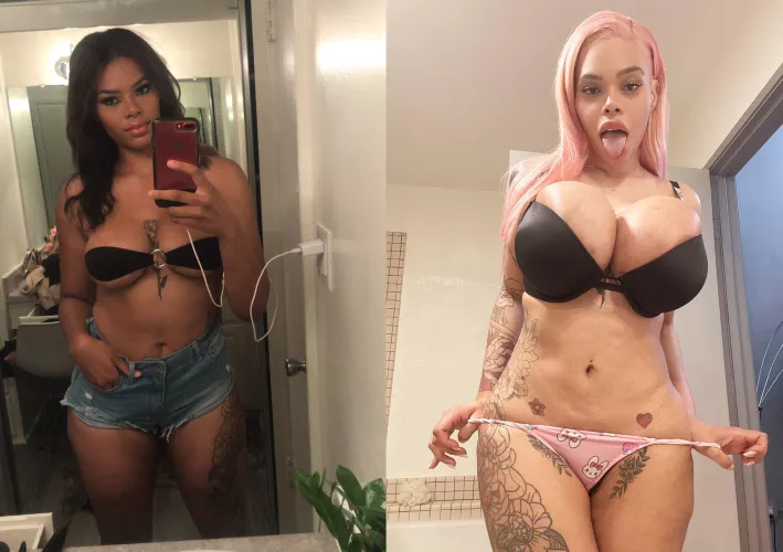 every woman looks so much better with implants