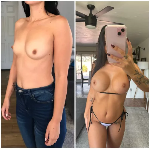 my 700 cc tits look so much better