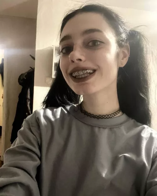 braces and pigtails again!! 