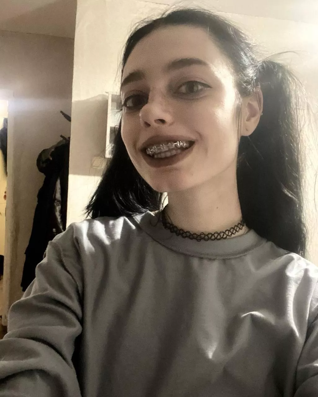 braces and pigtails again!! 