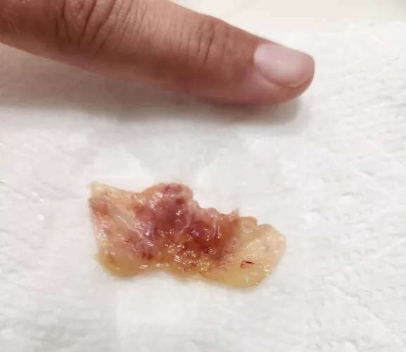 I am glad i was at home when i coughed this up