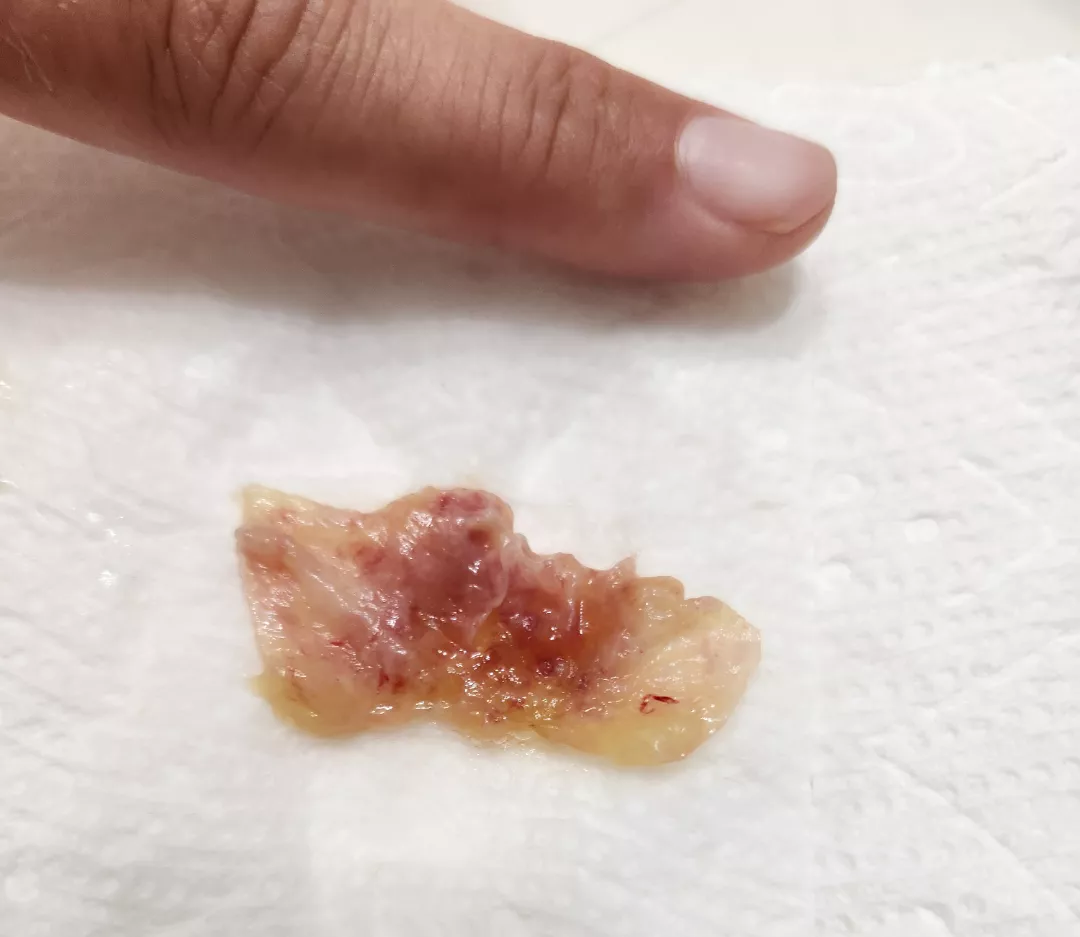 I am glad i was at home when i coughed this up