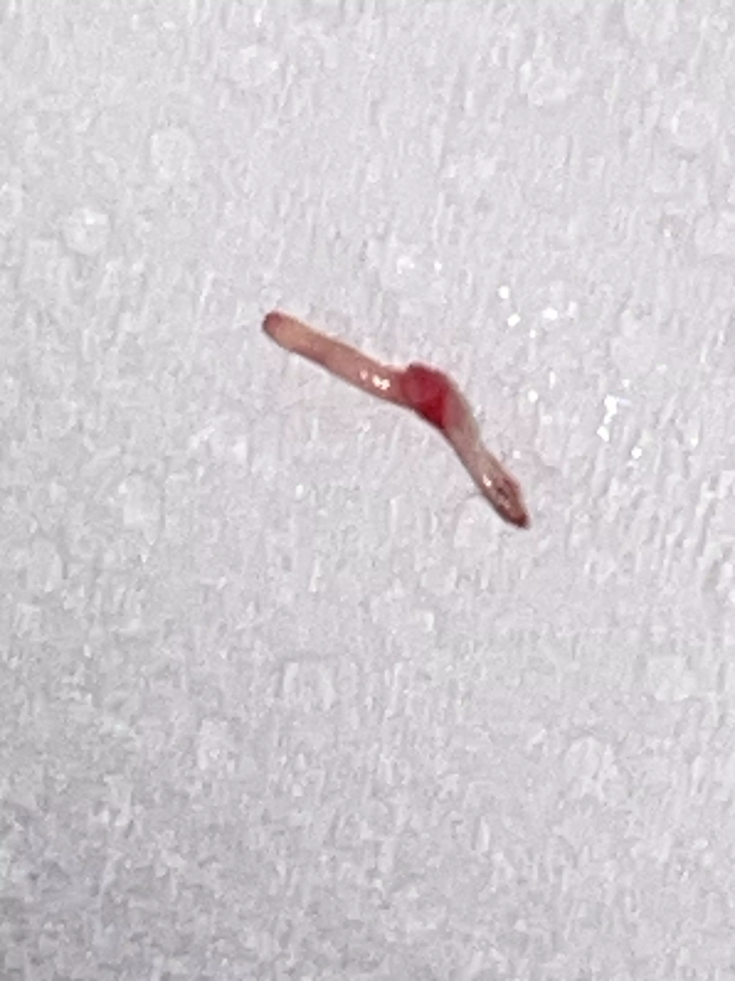 In-grown hair SAC!! Amazing and no more pain 