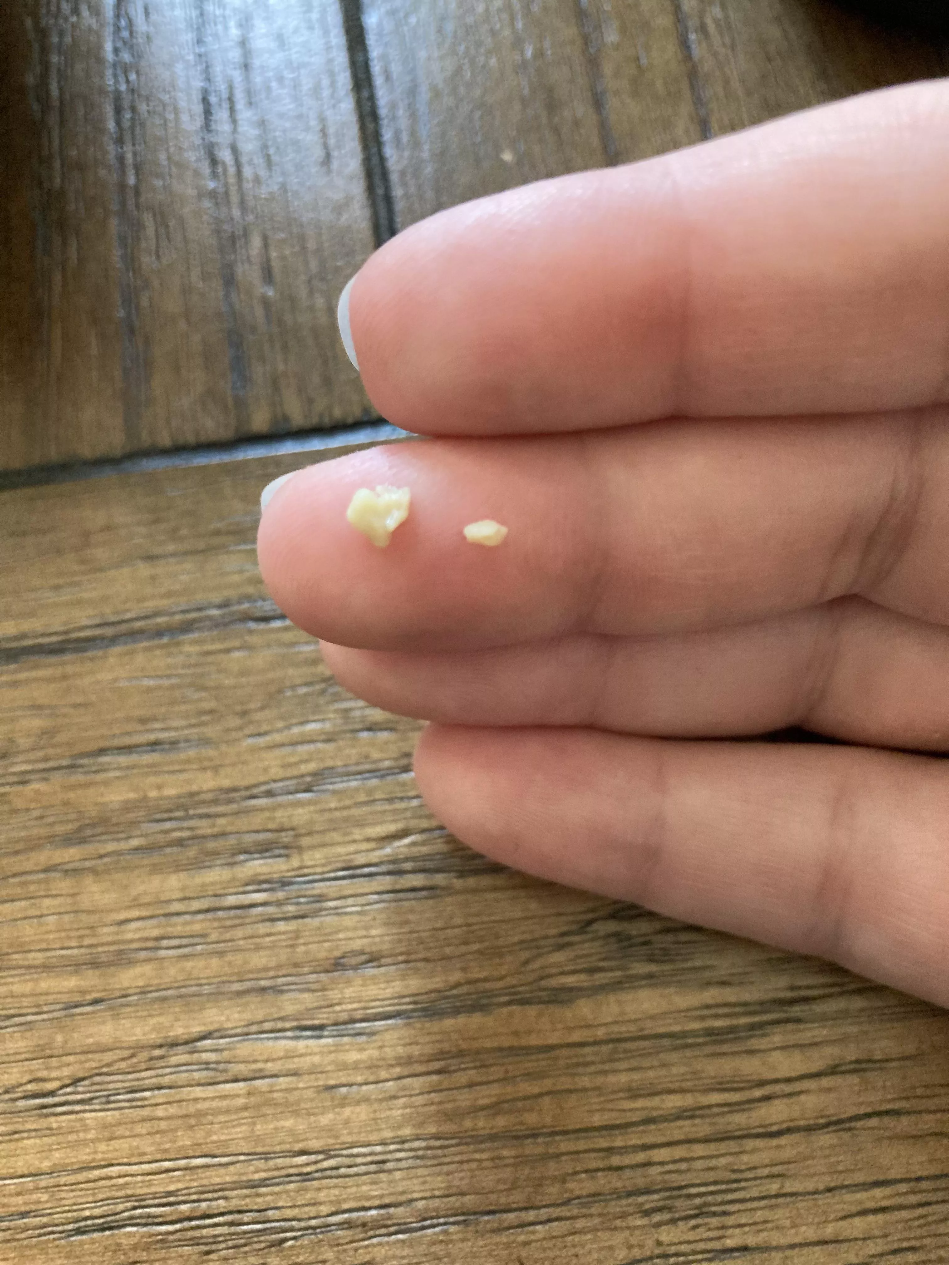 Coughed these up today