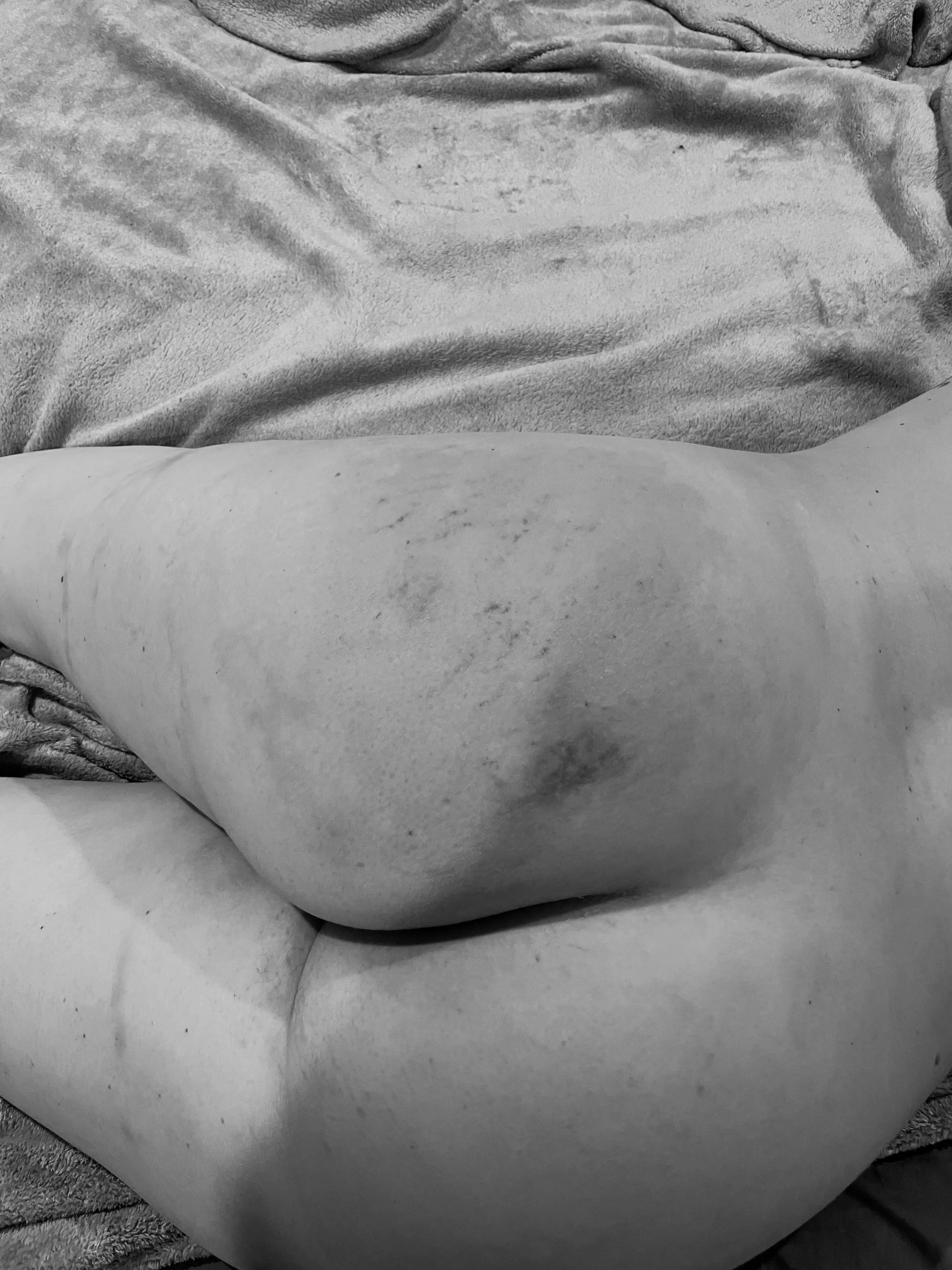 Left her bruised and marked