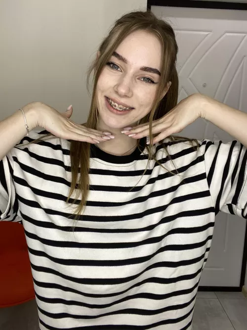 All I want is to get you excited! Do my braces help with that? 🤭