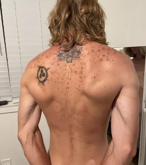 Do the spots ruin the tattoos?