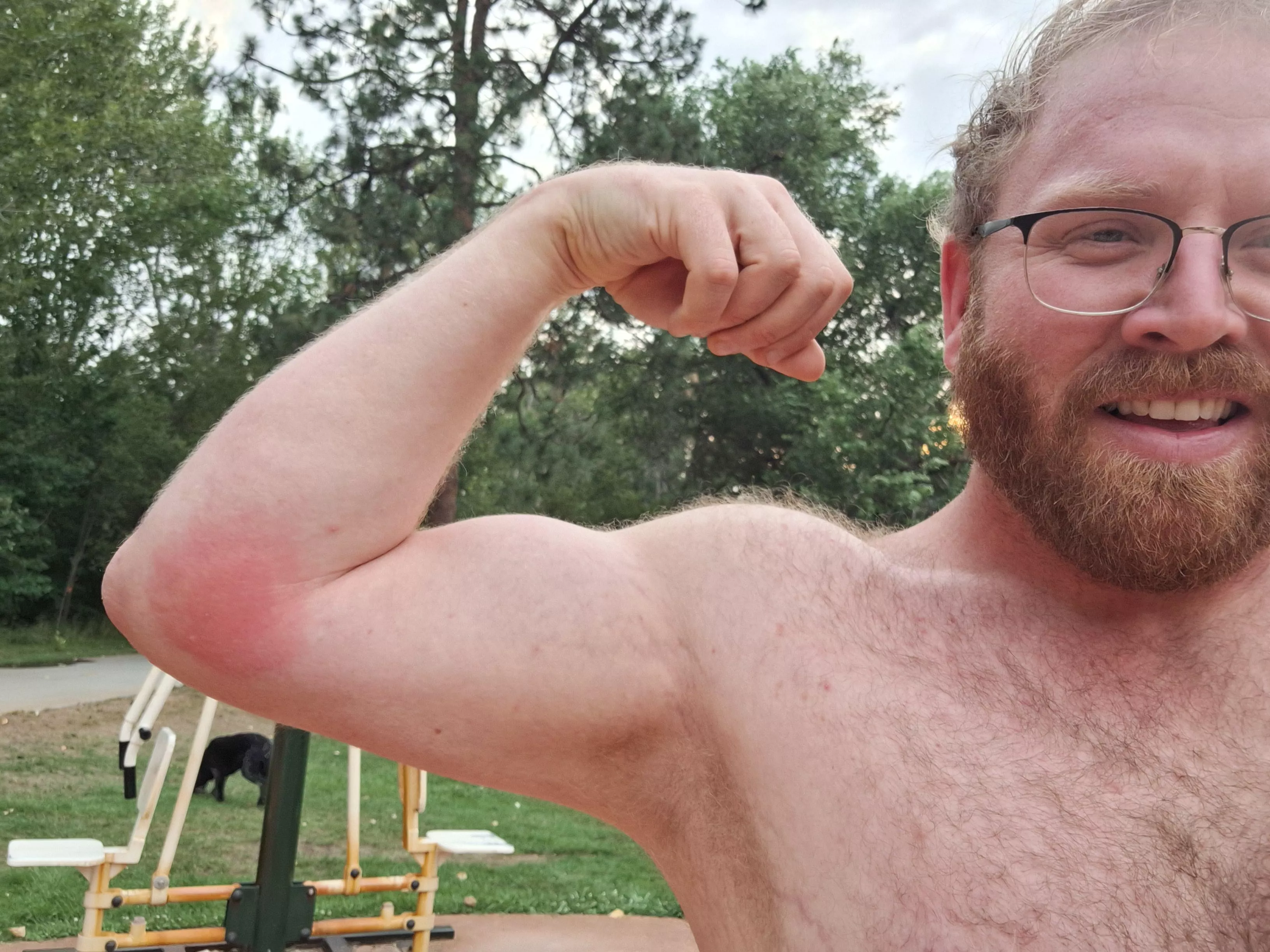 Hi from Boise, Idaho! Here you can see I got a wasp sting on my arm. Abundant wildlife, just one of the reasons to come visit Idaho 🥔