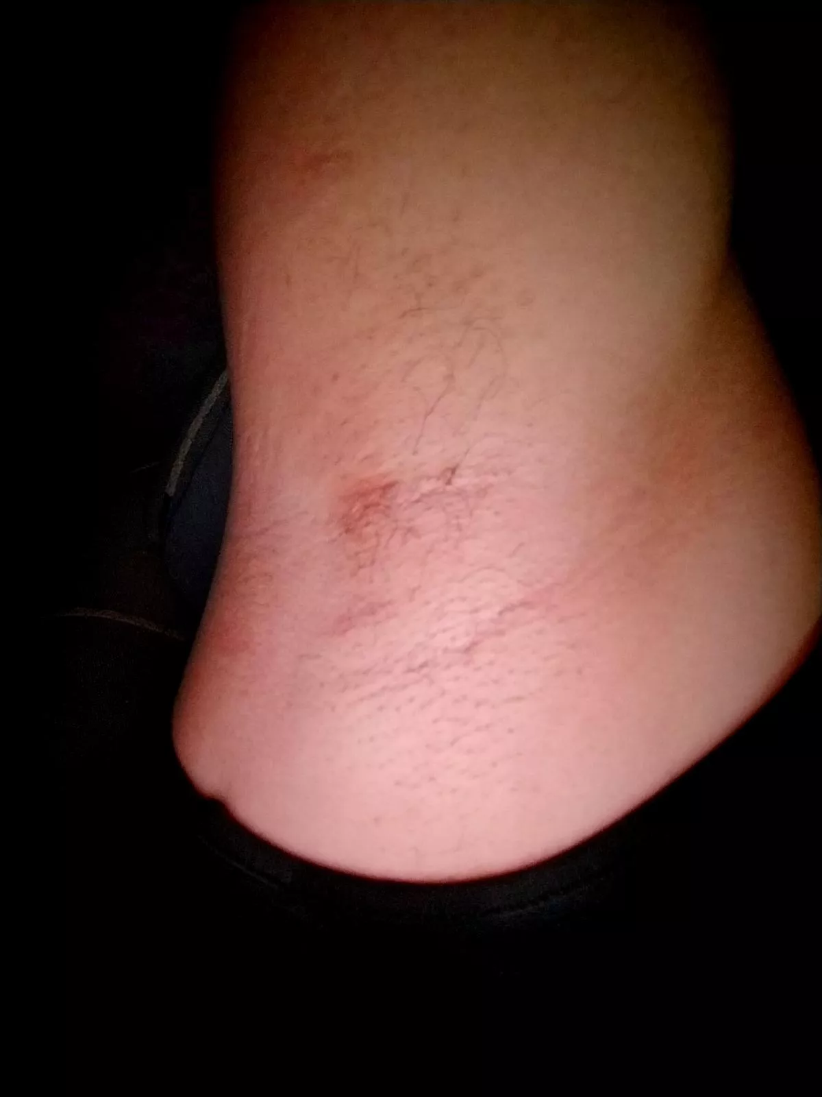 moisturize my skin with your tongue 