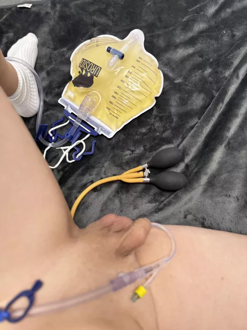 Awesome Setup! 😍 20CH Cath and 30CH Enema with 2 Ballons