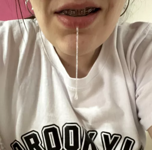 Braces and drool, isn't that the best combination?