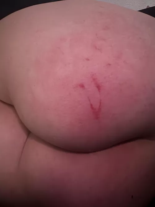 First post here. Red and marked. 